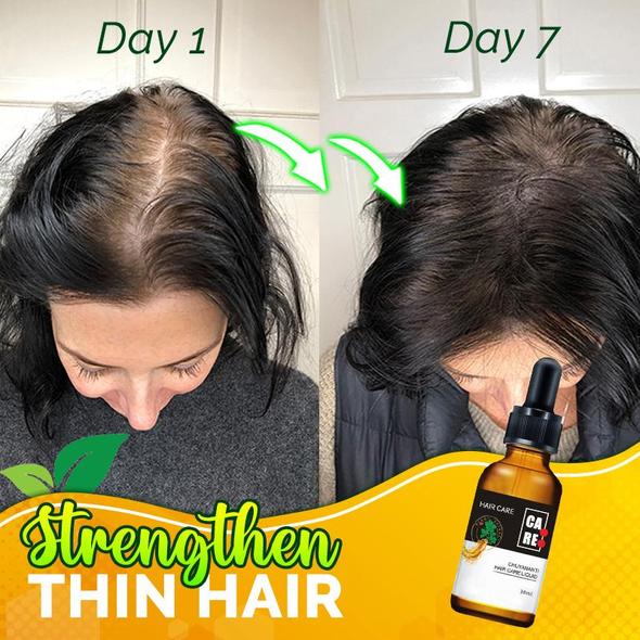 10X-Regro Strong Hair Serum - 💯BUY MORE SAVE MORE💯