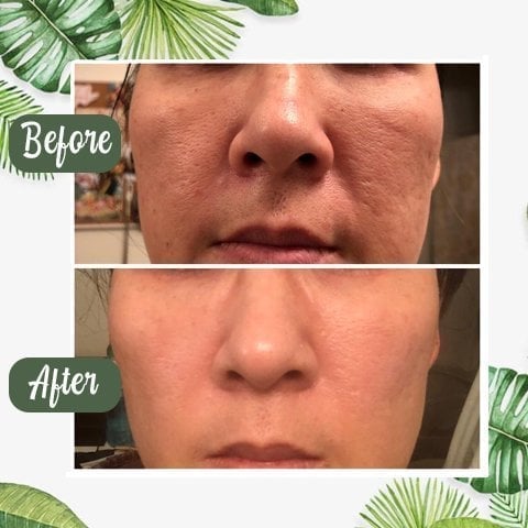 🎉 Buy 1 Get 1 Free-Deep Cleanse Green Tea Mask