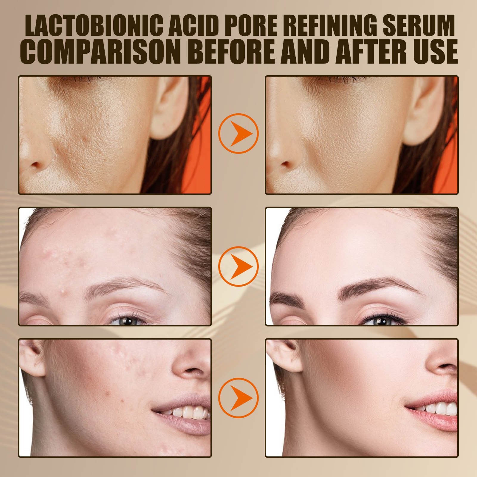 🔥Lactobionic acid pore contraction Face Serum