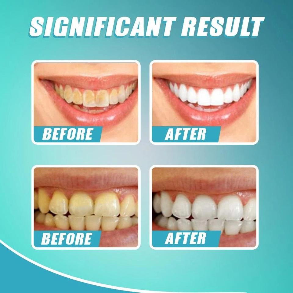 🎅Early Christmas Sale🎅Intensive stain remover whitening toothpaste（48% OFF)