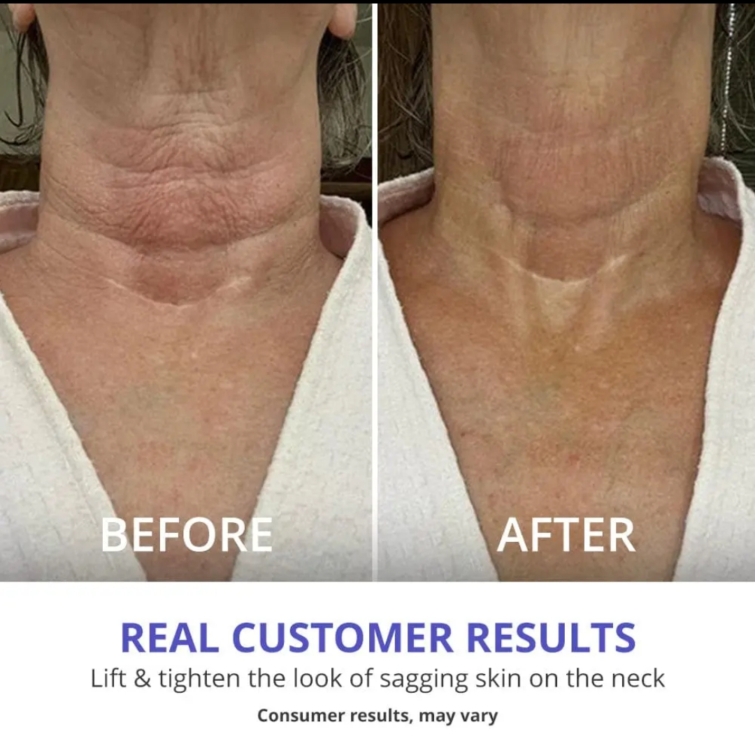 Neck Cream-Tighten & Life Firming Neck Cream for Crepey Skin