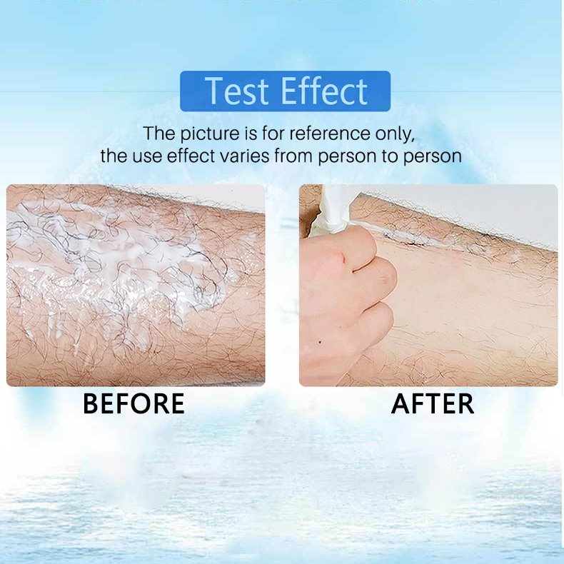🔥 2023 Magic Hair Removal & Hair Inhibitor【Buy 5+ Get Extra 25% OFF】