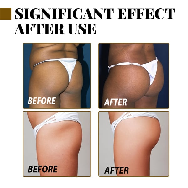 Beautiful Buttock Essential Oil