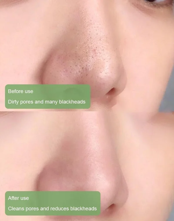 Last Day Promotion 70% OFF - 🔥Green Tea Deep Cleanse Mask