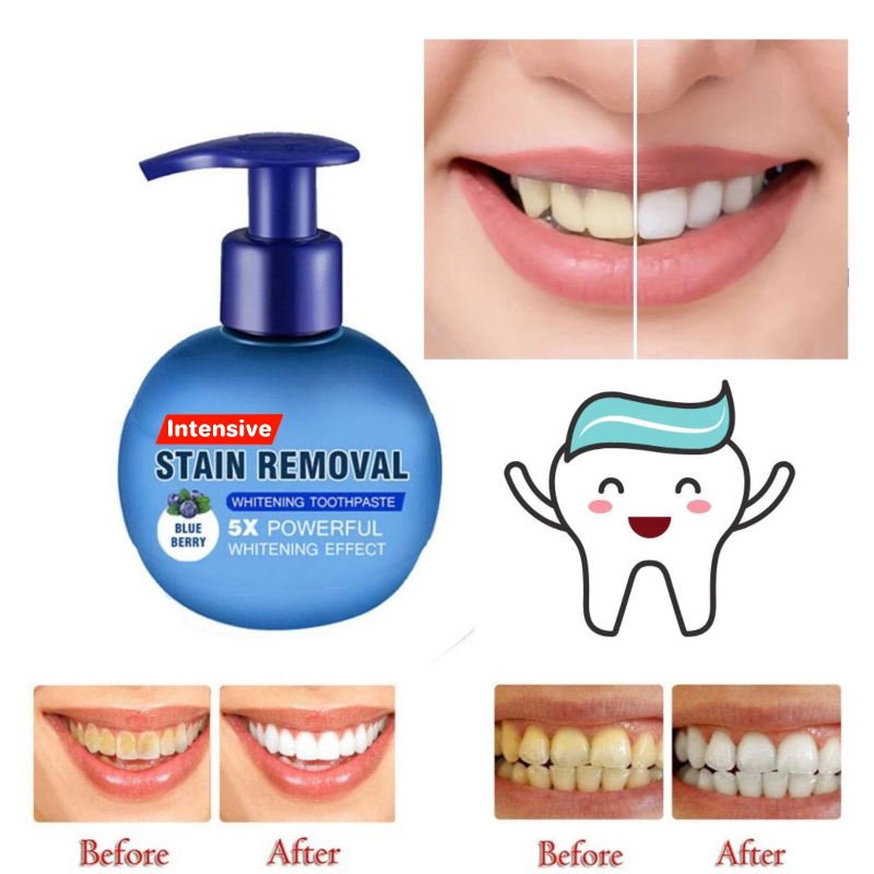 🎅Early Christmas Sale🎅Intensive stain remover whitening toothpaste（48% OFF)