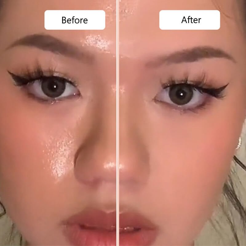 💃🏻Oil-Absorbing Volcanic Face Roller🖌️