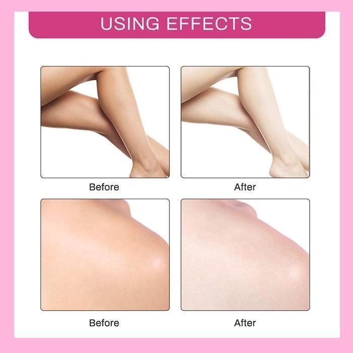 ❤️SUMMER DAY FLASH SALE--2021  NEW WHITENING CREAM