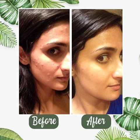 Last Day Promotion 70% OFF - 🔥Green Tea Deep Cleanse Mask