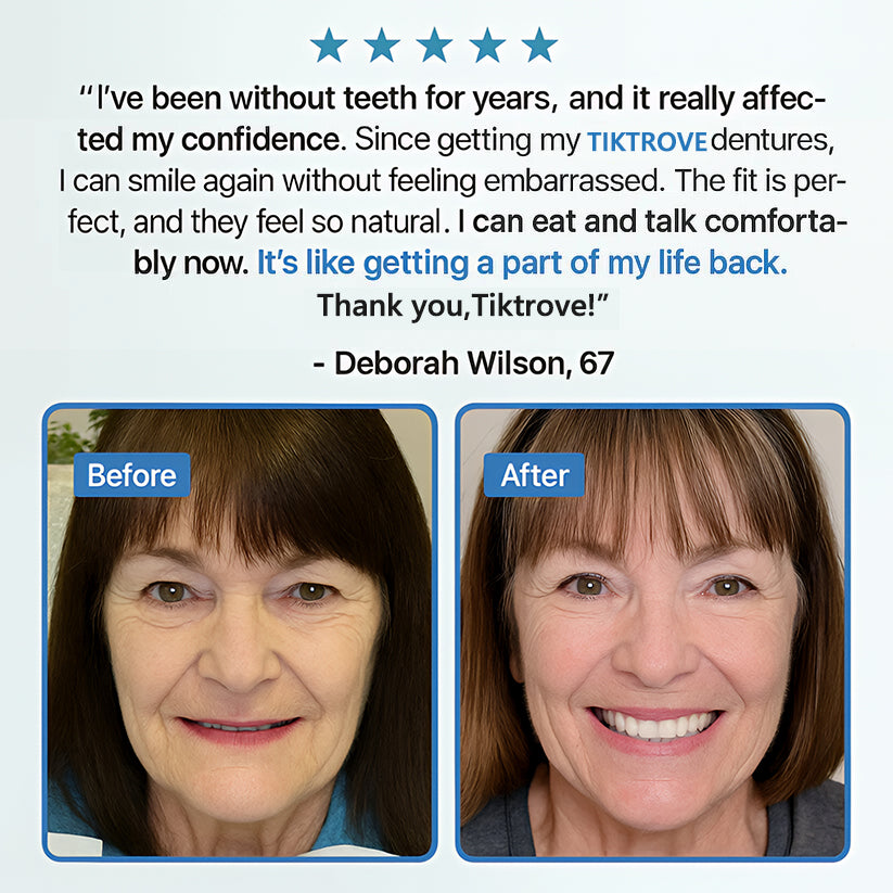 Tiktrove Adsorptive Denture