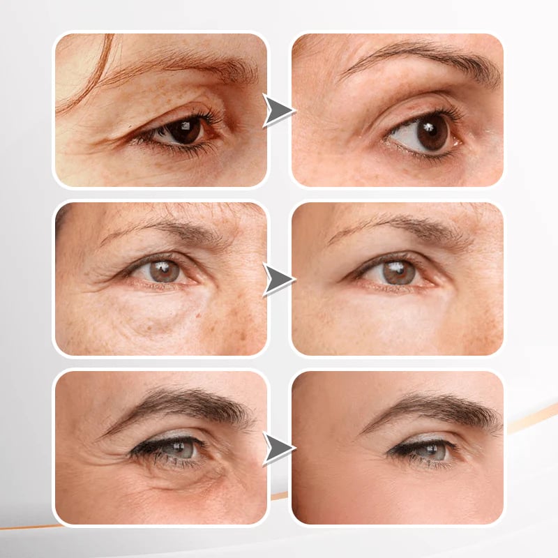 Youthful Lift Eye Firming Cream