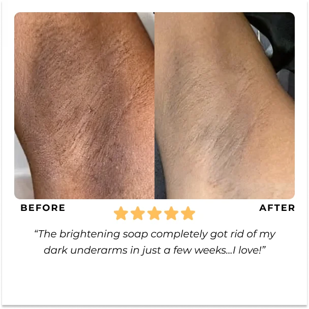 💖 Mother's Day discount 49% OFF-Lemon Turmeric and Kojic Acid Skin Brightening Soap(1 SETS 2 PCS 🔥BUY MORE SAVE MORE )