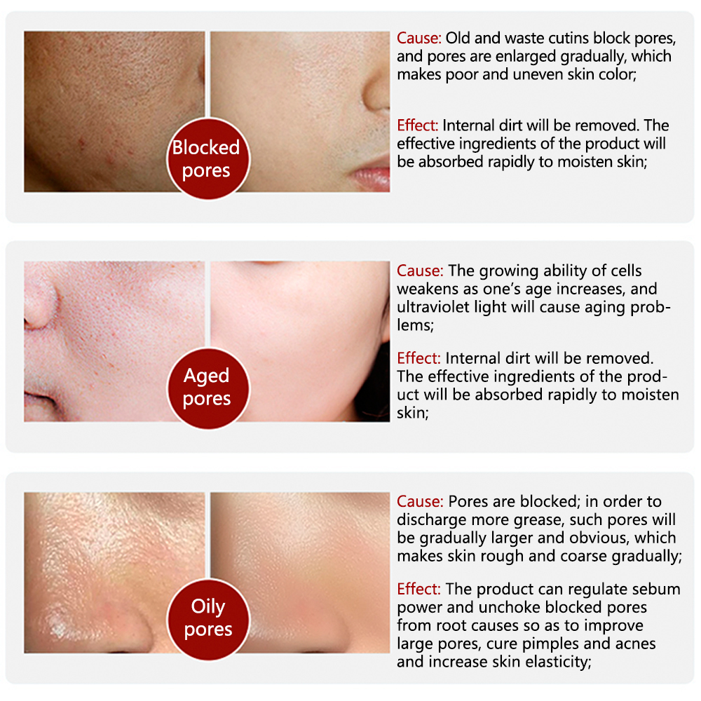 (🔥CHRISTMAS HOT SALE-48% OFF)2021 New Magical Perfecting Base Face Primer Under Foundation-BUY 2 GET 1 FREE TODAY!