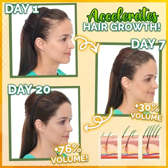 10X-Regro Strong Hair Serum - 💯BUY MORE SAVE MORE💯
