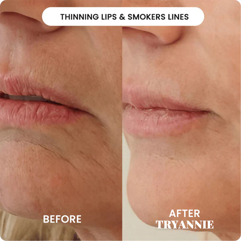 The Micro Infusion System