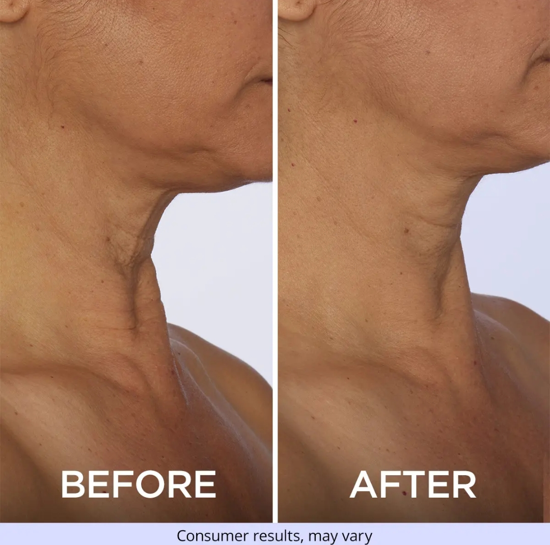 Neck Cream-Tighten & Life Firming Neck Cream for Crepey Skin
