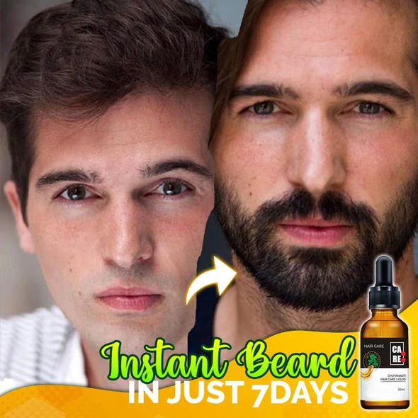 10X-Regro Strong Hair Serum - 💯BUY MORE SAVE MORE💯