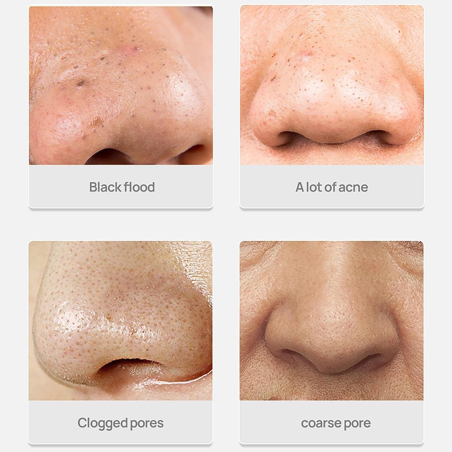 (🔥Last Day Promotion-SAVE 50% OFF)✨2023 New Deep Cleanse Mask With Free 60pcs Sticker-Buy 2 Get 1 Free & Free Shipping