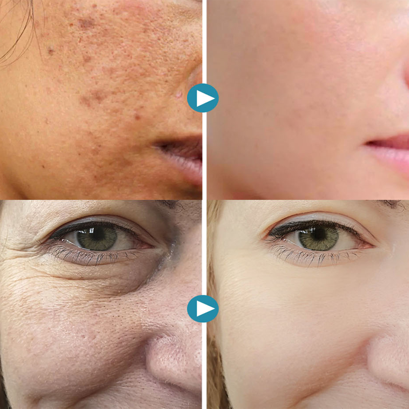 (🔥CHRISTMAS HOT SALE-48% OFF)2021 New Magical Perfecting Base Face Primer Under Foundation-BUY 2 GET 1 FREE TODAY!
