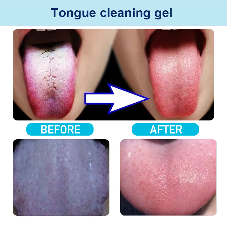 Healthy Oral Hygiene Brush & Tongue Cleansing Gel