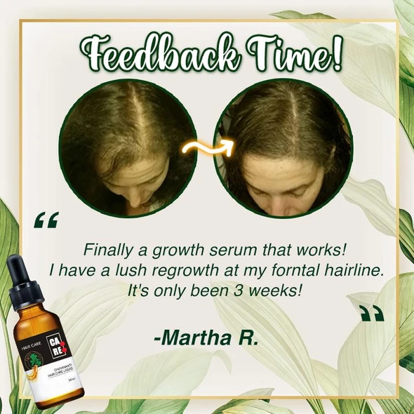 10X-Regro Strong Hair Serum - 💯BUY MORE SAVE MORE💯