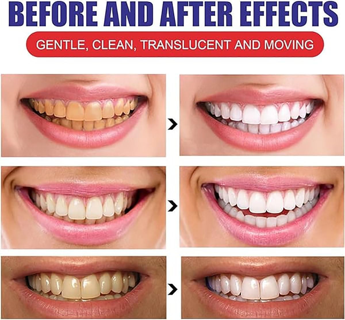 🔥Mother's Day discount 49%🔥 Fluoride-free gum protection, anti-caries repair, rapid whitening toothpaste