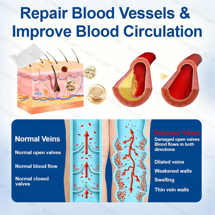 💧🧫GFOUK® VeinTarget Microneedle Patch⚡Instant Relief, Long-Term Results
