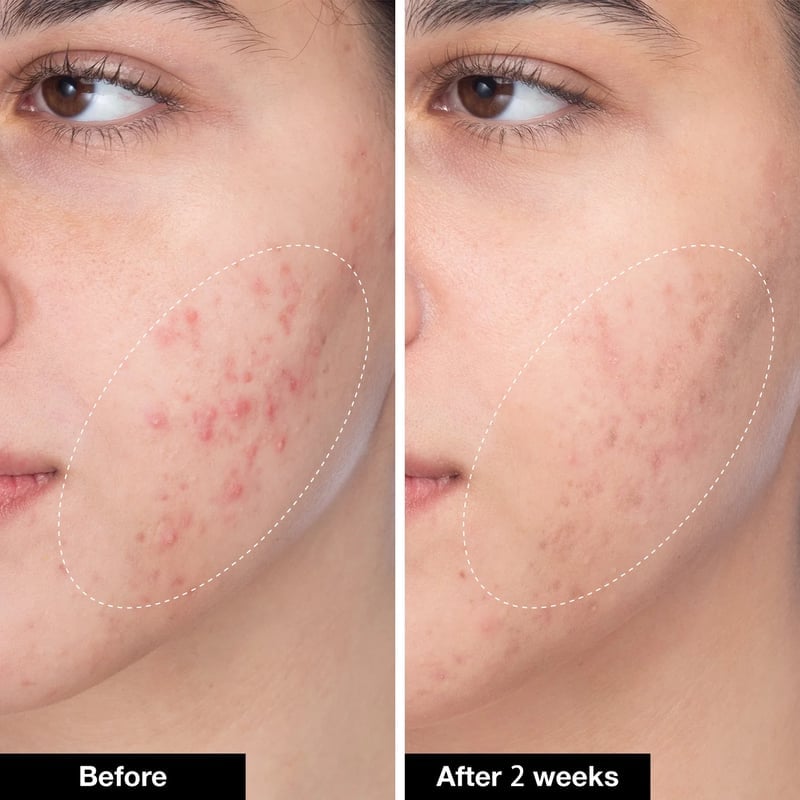🔥Last Day Promotion 49% OFF🎁- New Revitalizing Collagen & Retinol Serum