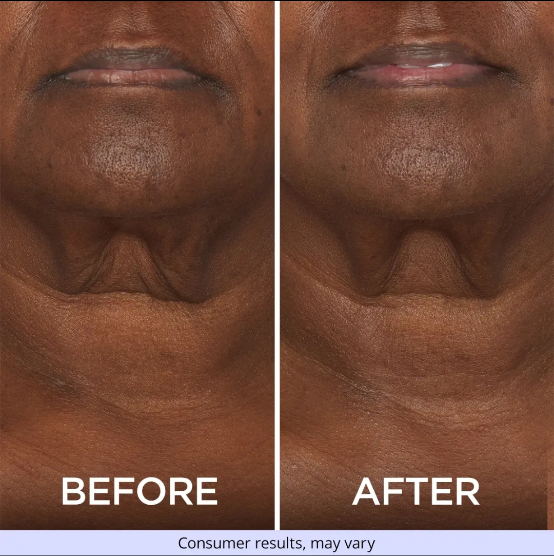 Neck Cream-Tighten & Life Firming Neck Cream for Crepey Skin