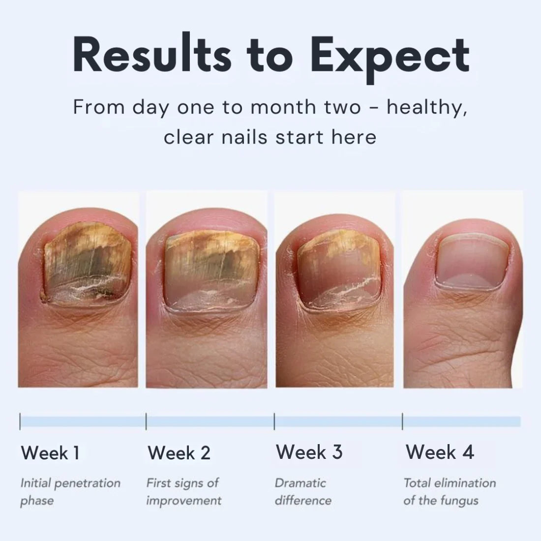 Tiktrove™ Antifungal Pen