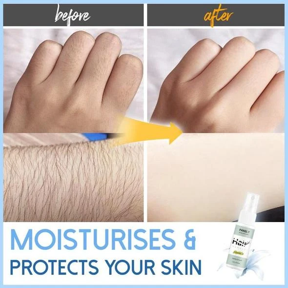 (🔥Summer Hot Sale 50% OFF) Semi-permanent Hair Removal Spray - BUY 4 FREE SHIPPING