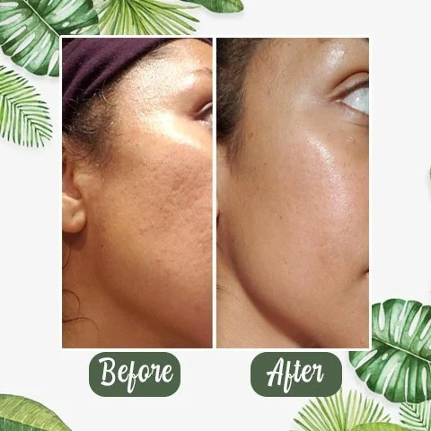 Last Day Promotion 70% OFF - 🔥Green Tea Deep Cleanse Mask