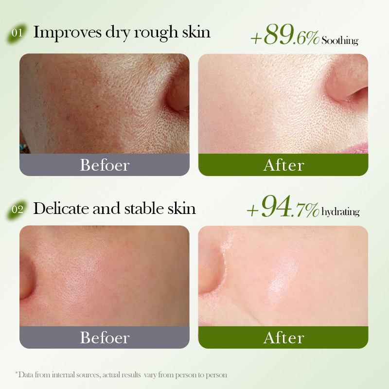 Plant fruit mask moisturizes and hydrates the skin, deeply soothes the skin, and provides long-lasting moisturizing