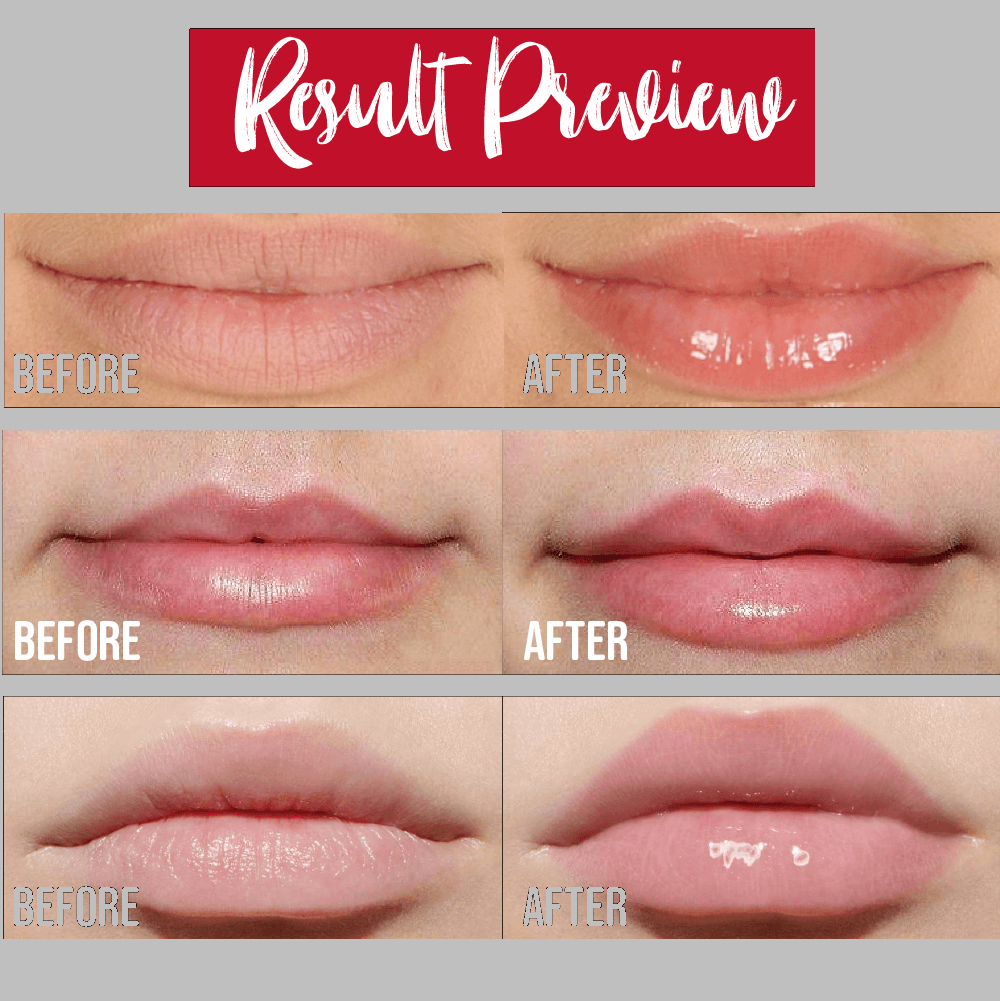 Instant Lip Plumping Serum--Beautiful You Deserve A Such Great Gift--BUY 2 GET 1 FREE, BUY 3 GET 2 FREE