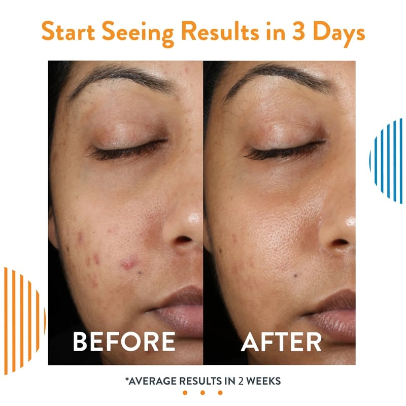 🔥Last Day Promotion 49% OFF🎁- New Revitalizing Collagen & Retinol Serum