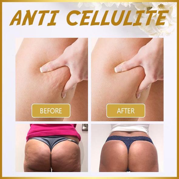 Herbal Slimming Massage Oil ( BUY 2 GET 1 FREE + 48% OFF TODAY )
