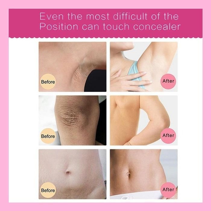 ❤️SUMMER DAY FLASH SALE--2021  NEW WHITENING CREAM