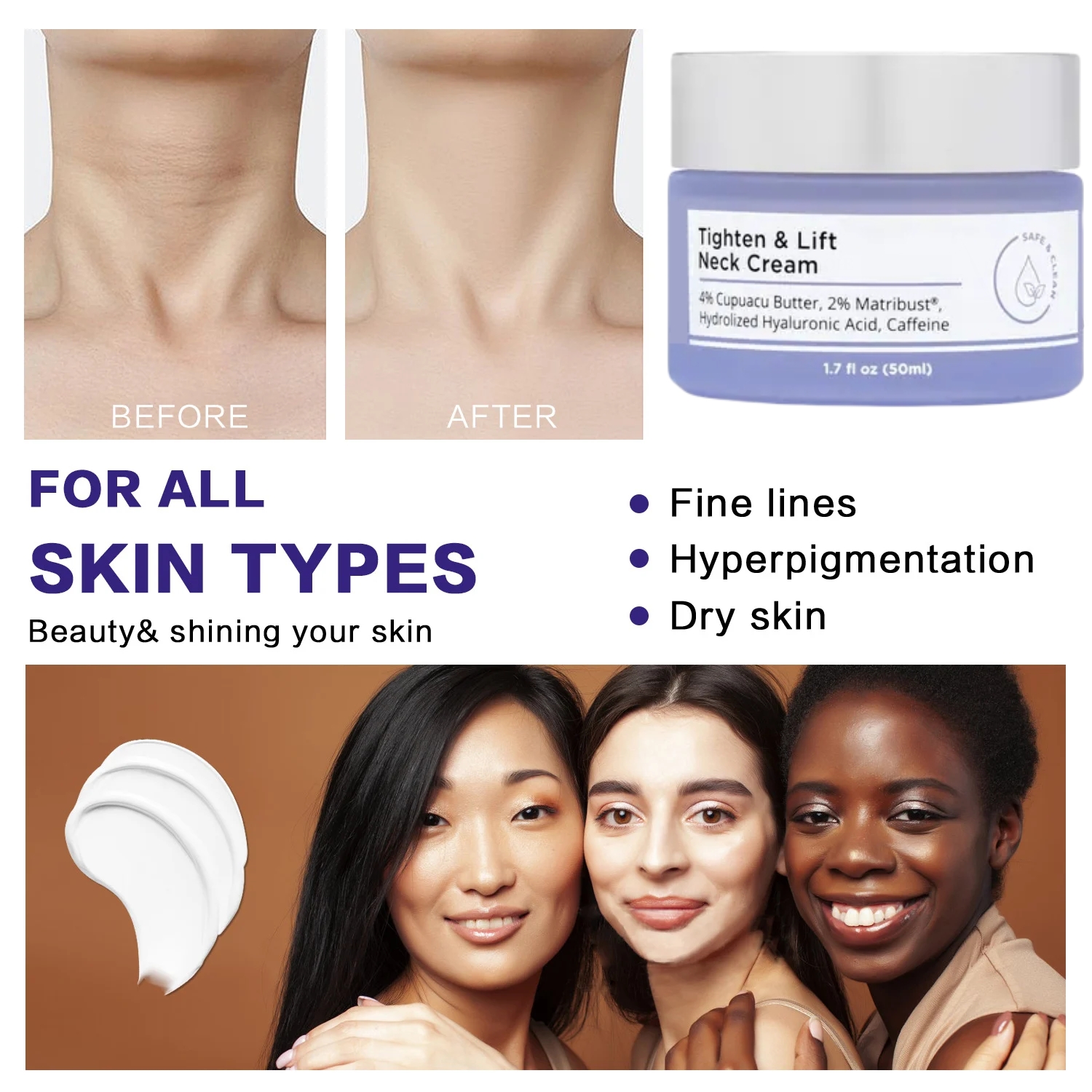 👍Last Day Promotion 50% OFF💥Tighten & Lift Firming Neck Cream for Crepey Skin