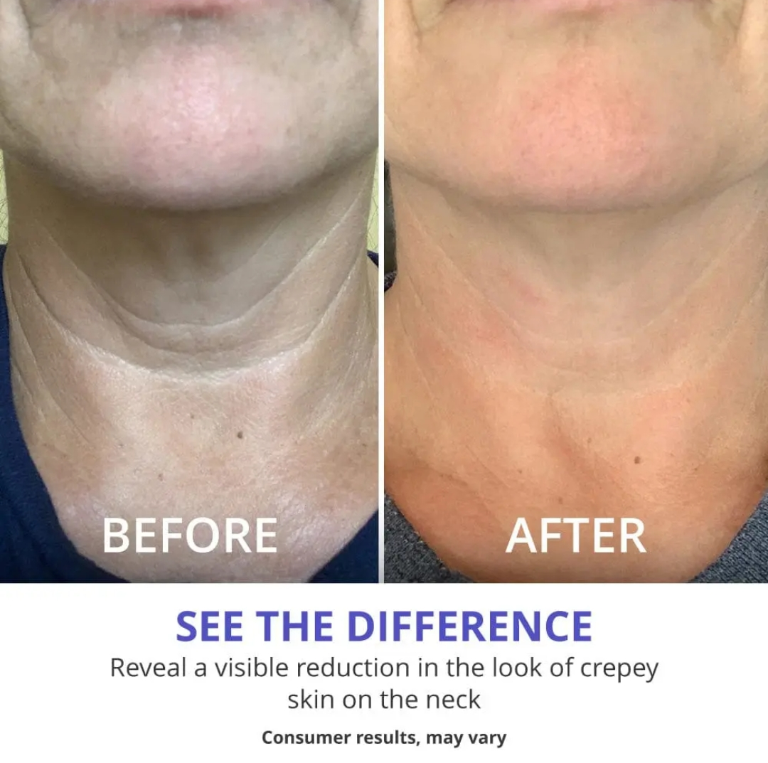 Neck Cream-Tighten & Life Firming Neck Cream for Crepey Skin
