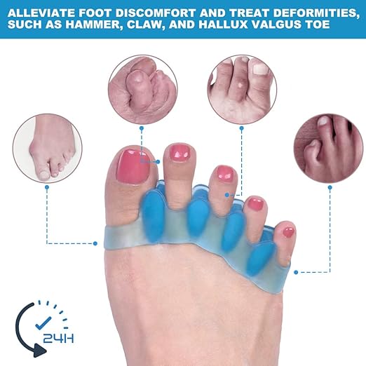 Correcting Bunions and Restoring Toes