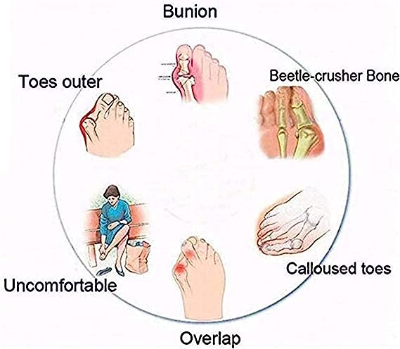 (🔥Last Day Promotion-SAVE 50% OFF)Soft Footbed Orthopedic Sandals - Buy 2 Get Free Shipping