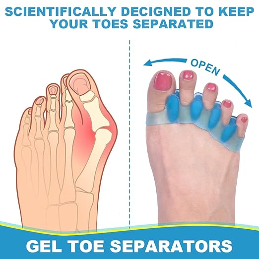 Correcting Bunions and Restoring Toes
