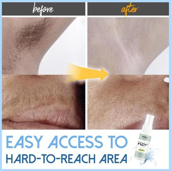(🔥Summer Hot Sale 50% OFF) Semi-permanent Hair Removal Spray - BUY 4 FREE SHIPPING