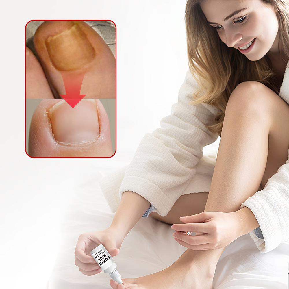 Toenail Fungus Treatment Extra Strength
