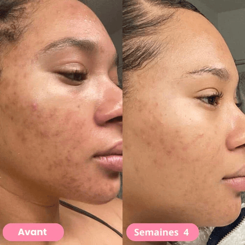 🔥Last Day 49% OFF-🧽Turmeric Skincare Set – Deep Cleanse, Brighten & Hydrate