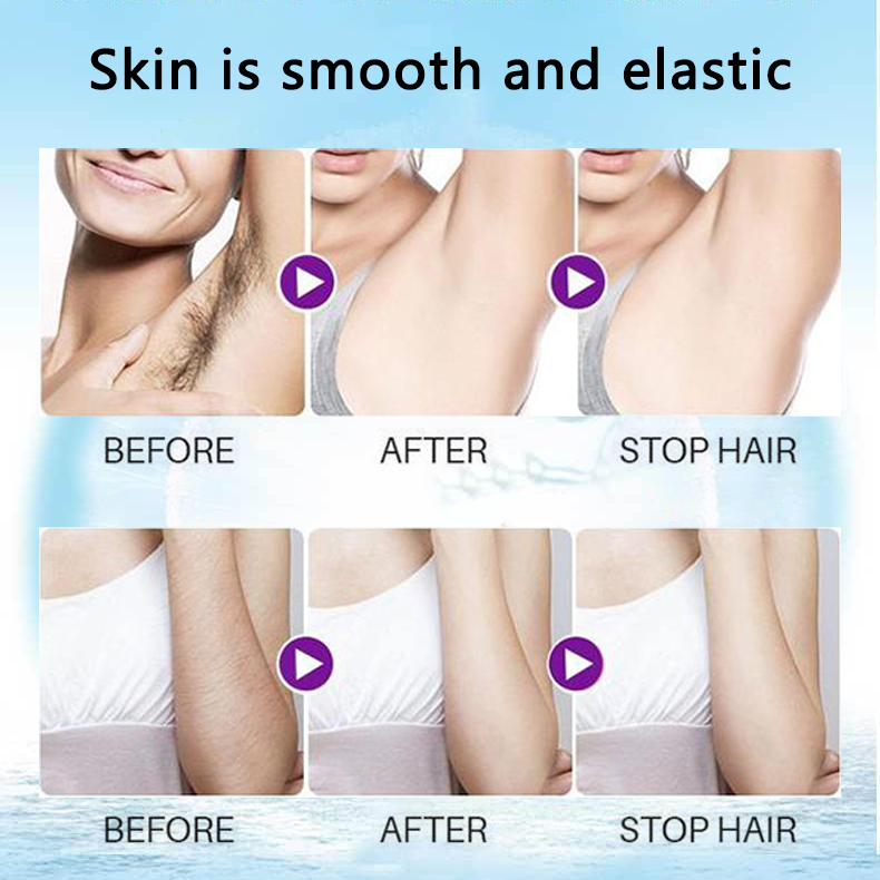 🔥 2023 Magic Hair Removal & Hair Inhibitor【Buy 5+ Get Extra 25% OFF】