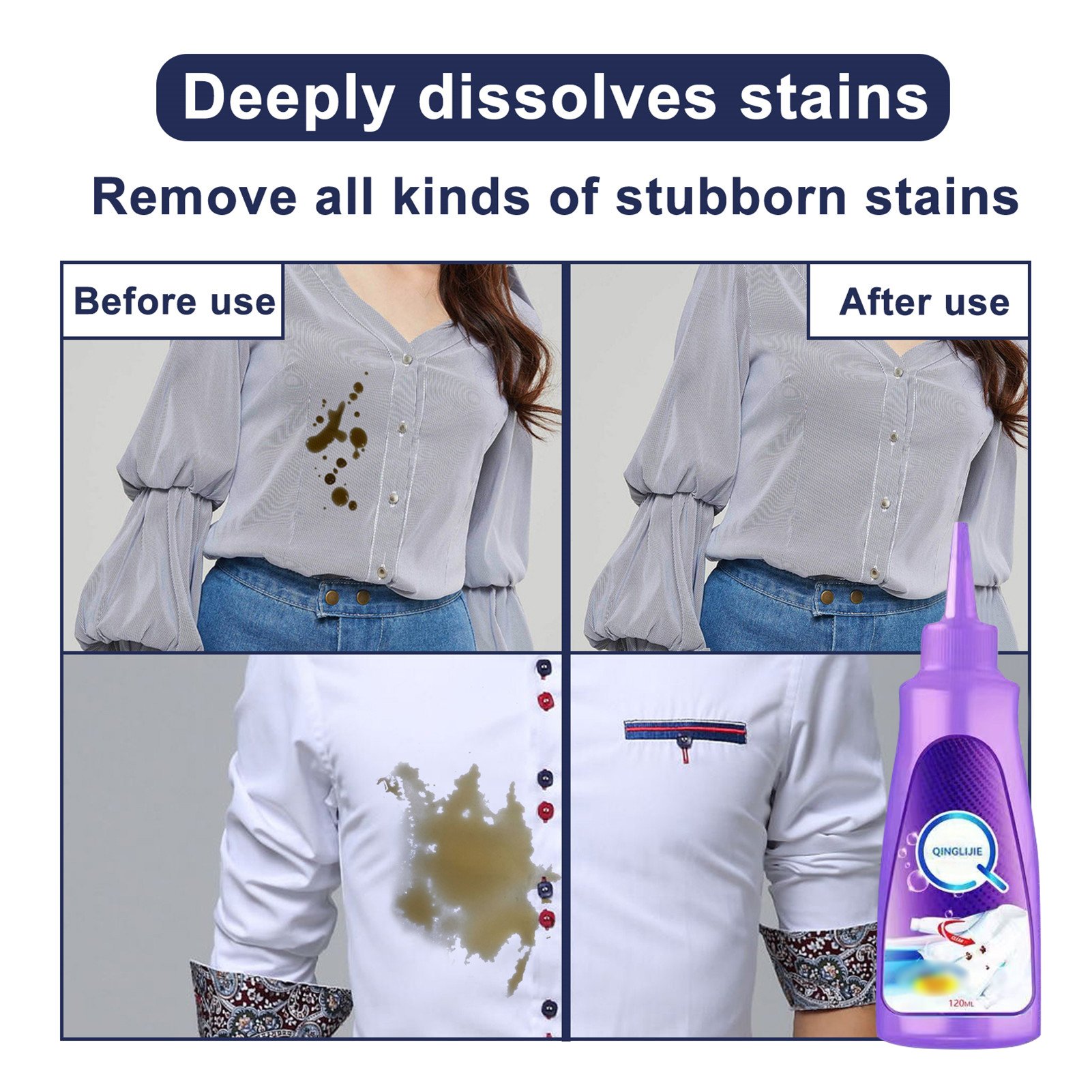 (🌲Early Christmas Sale- SAVE 49% OFF)Magic Stain Remover Rolling-⏰BUY 2 GET 1 FREE