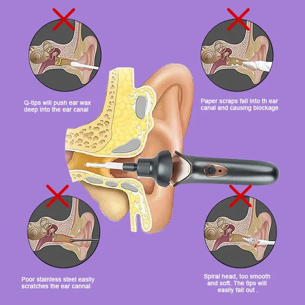 🔥2024 New Year Hot Sale🔥Painless ear cleaning for the whole family