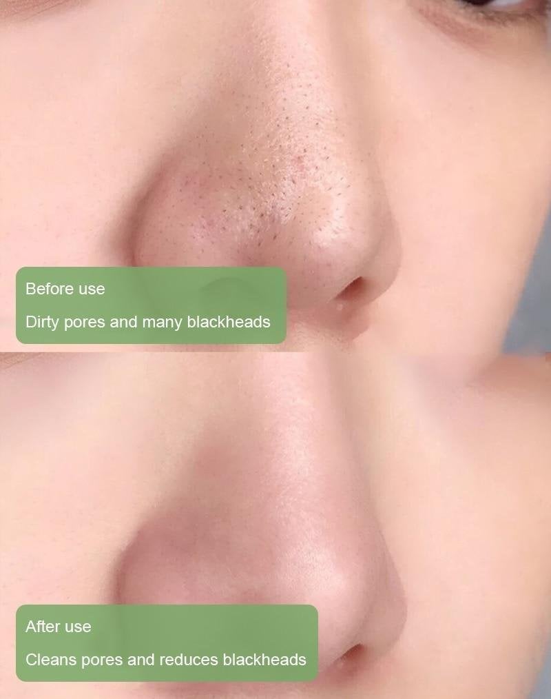 🎉 Buy 1 Get 1 Free-Deep Cleanse Green Tea Mask