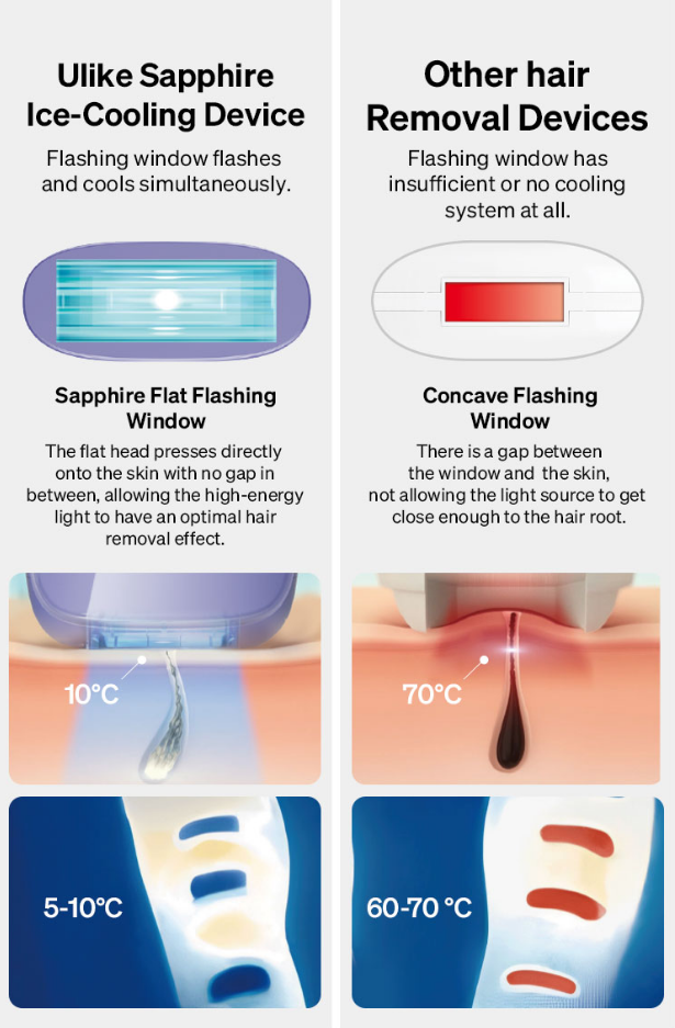 Ulike Air3 sapphire hair removal