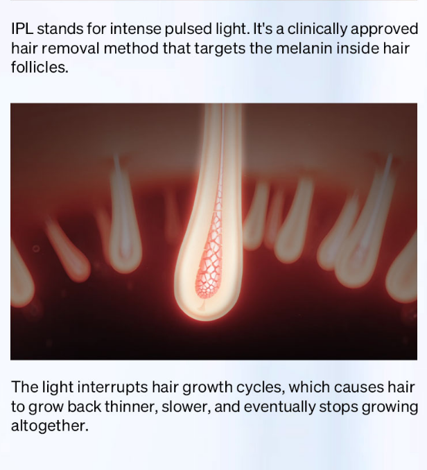 Ulike Air3 sapphire hair removal